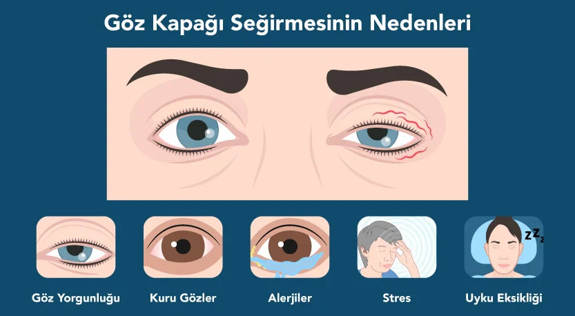 Göz Kapağı Seğirmesi