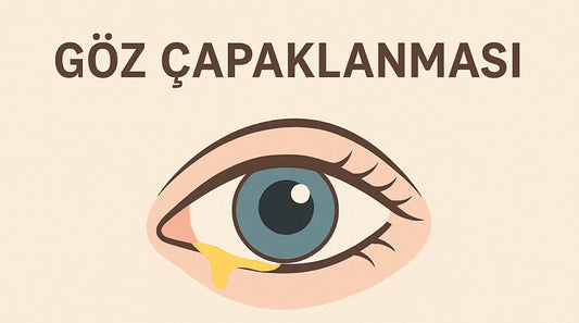 Göz Çapaklanması Nedir?