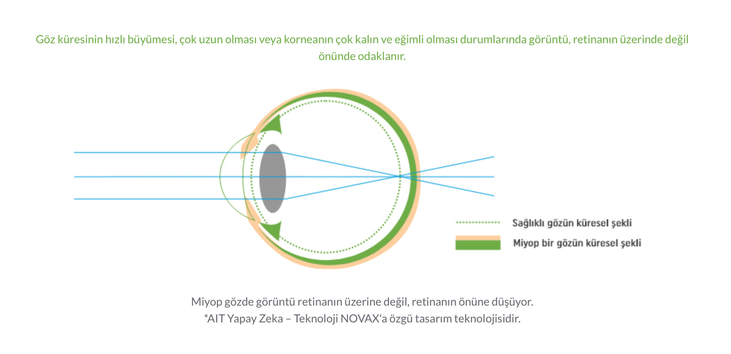 Nowax Miyopi-X Çocuklarda Miyopi Kontrol Camı