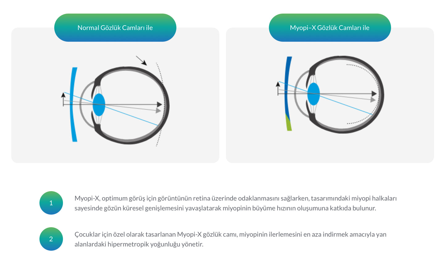 Nowax Miyopi-X Çocuklarda Miyopi Kontrol Camı