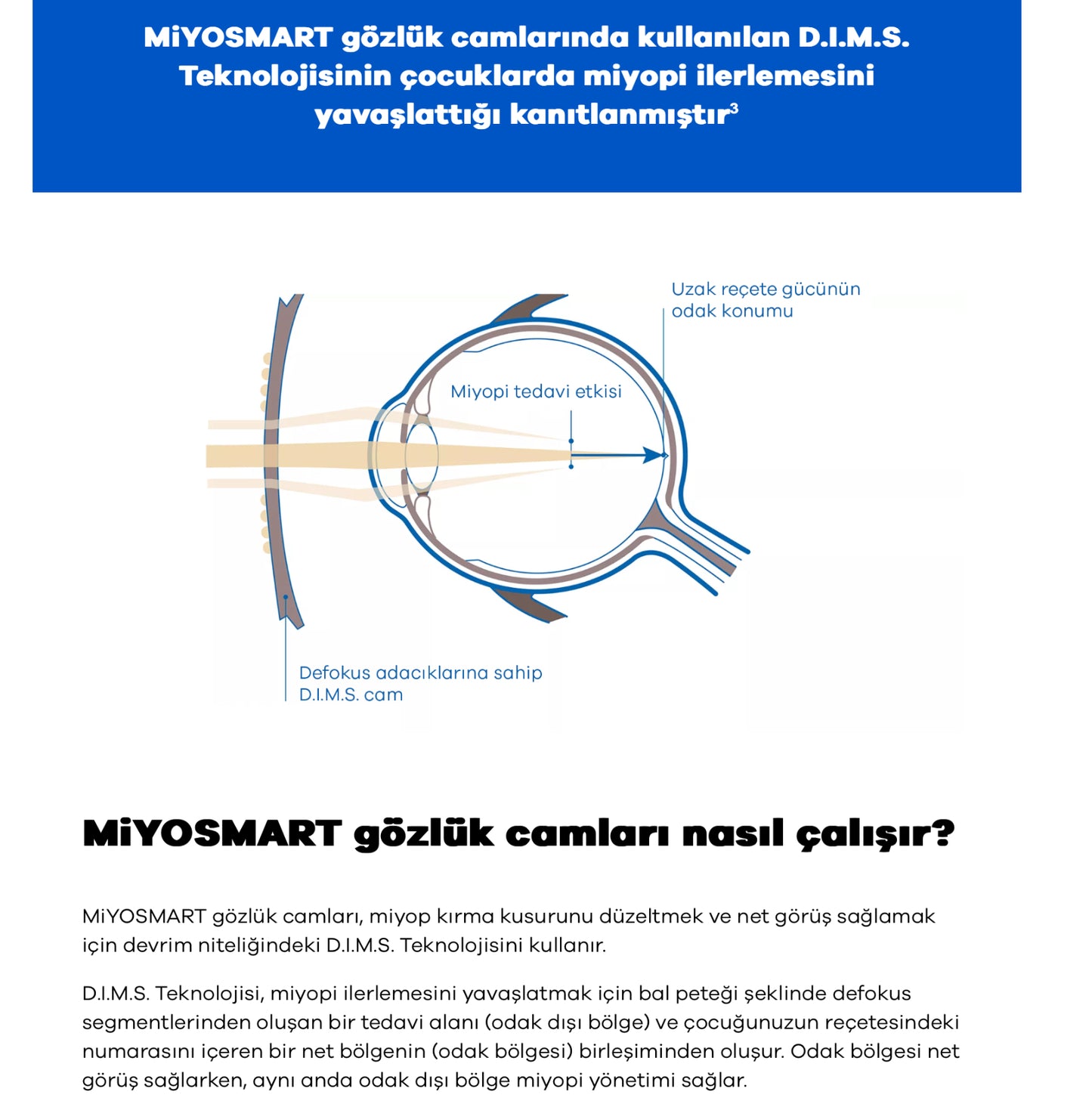 Hoya Miyosmart Çocuklarda Miyopi Kontrol Camı