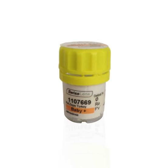 Orbis Baby (Bebek Lensi)