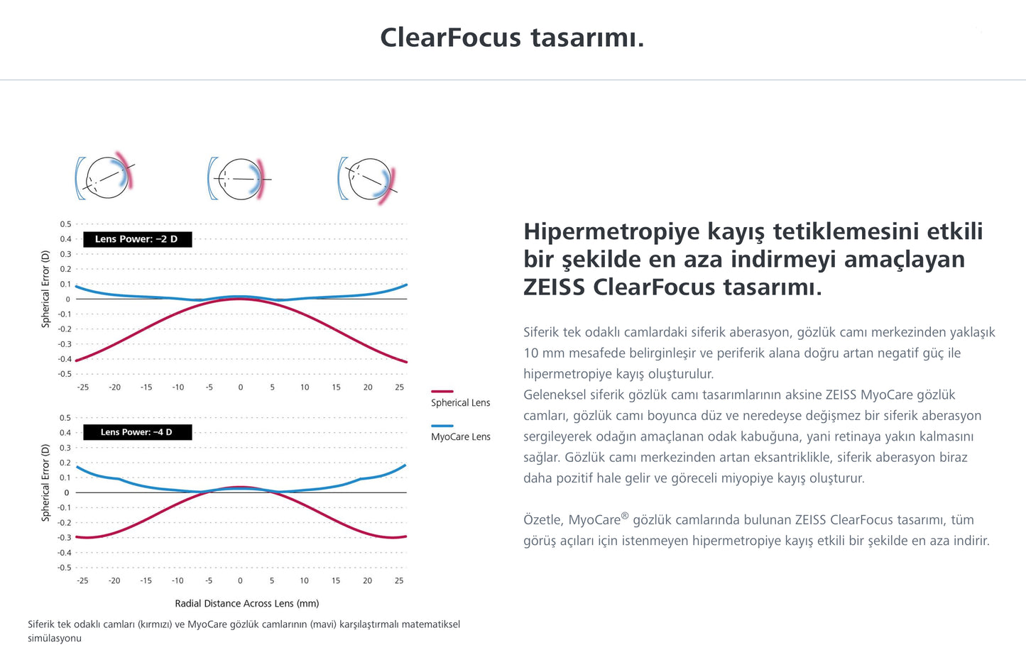 Zeiss MyoCare Çocuklarda Etkili Miyopi Camı