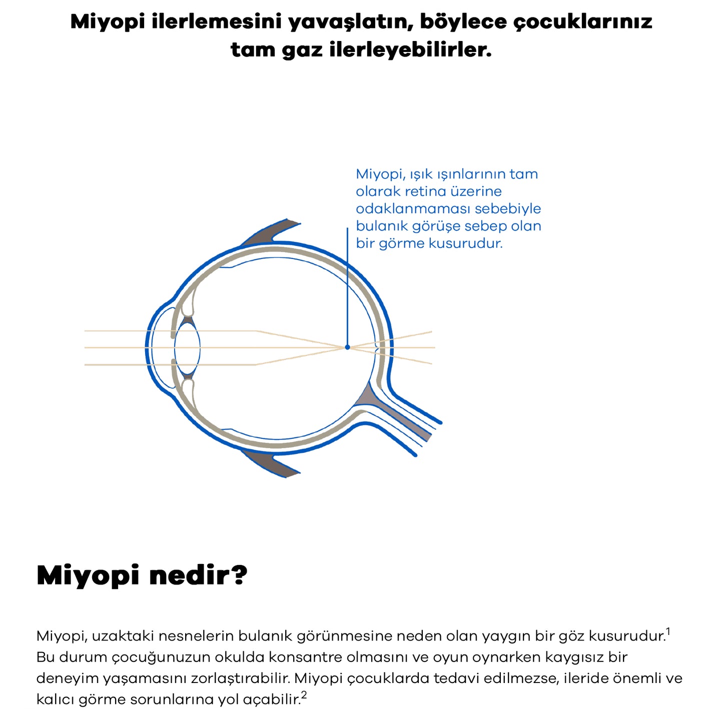 Hoya Miyosmart Çocuklarda Miyopi Kontrol Camı