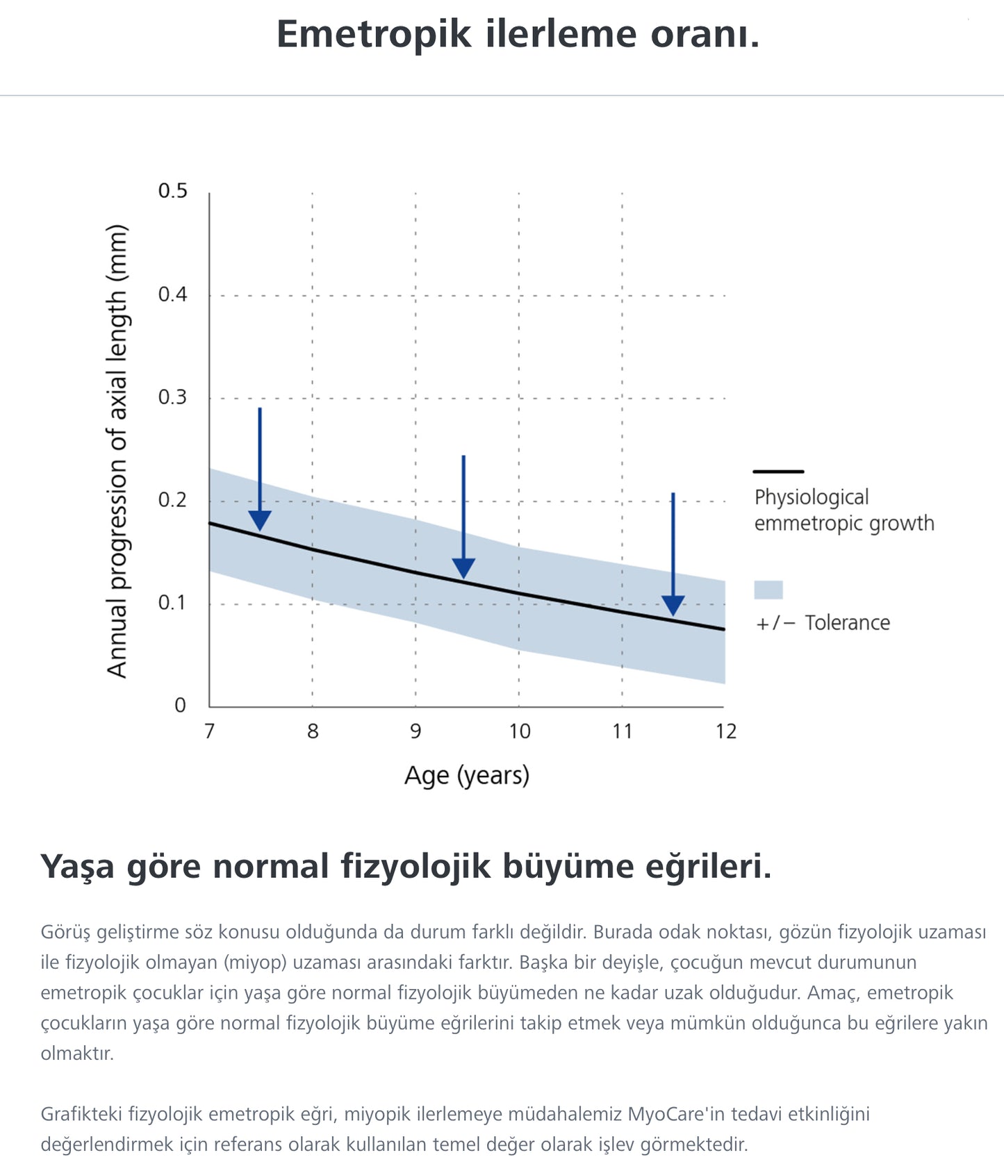 Zeiss MyoCare Çocuklarda Etkili Miyopi Camı