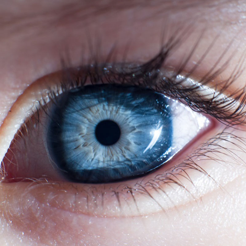 Kare Optik Göz Anatomisi